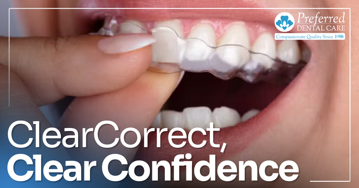 Palanca-Beveridge Email March 2026