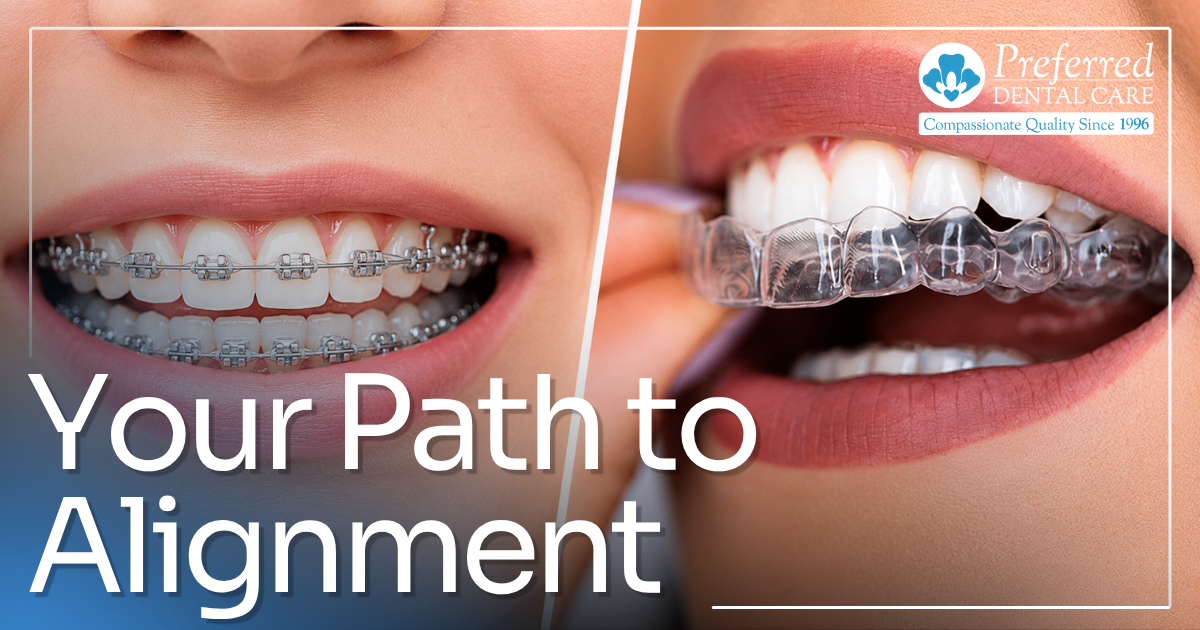 teeth with braces and teeth with clear aligners